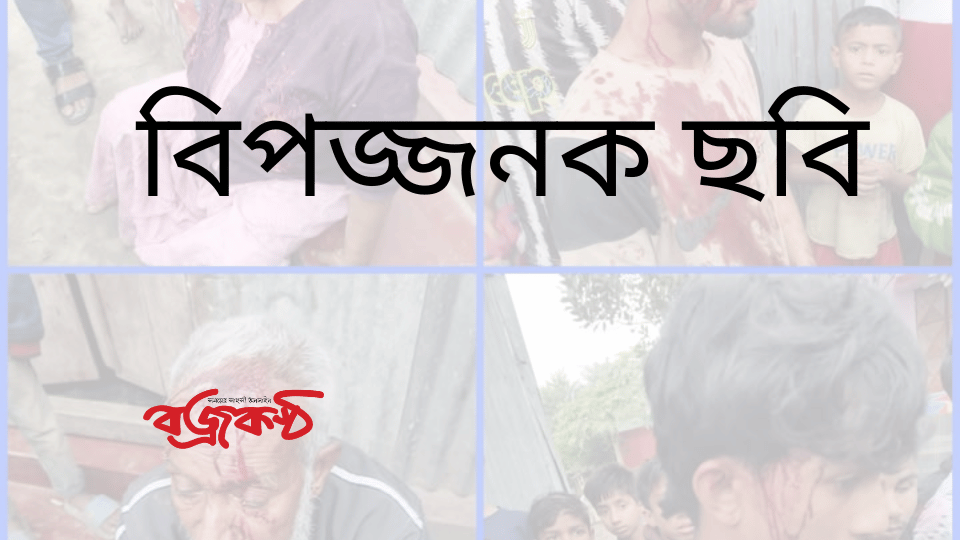 মাধবপুরে ক্রিকেট খেলা নিয়ে দুপক্ষের সংঘর্ষে নারী সহ আহত-২১